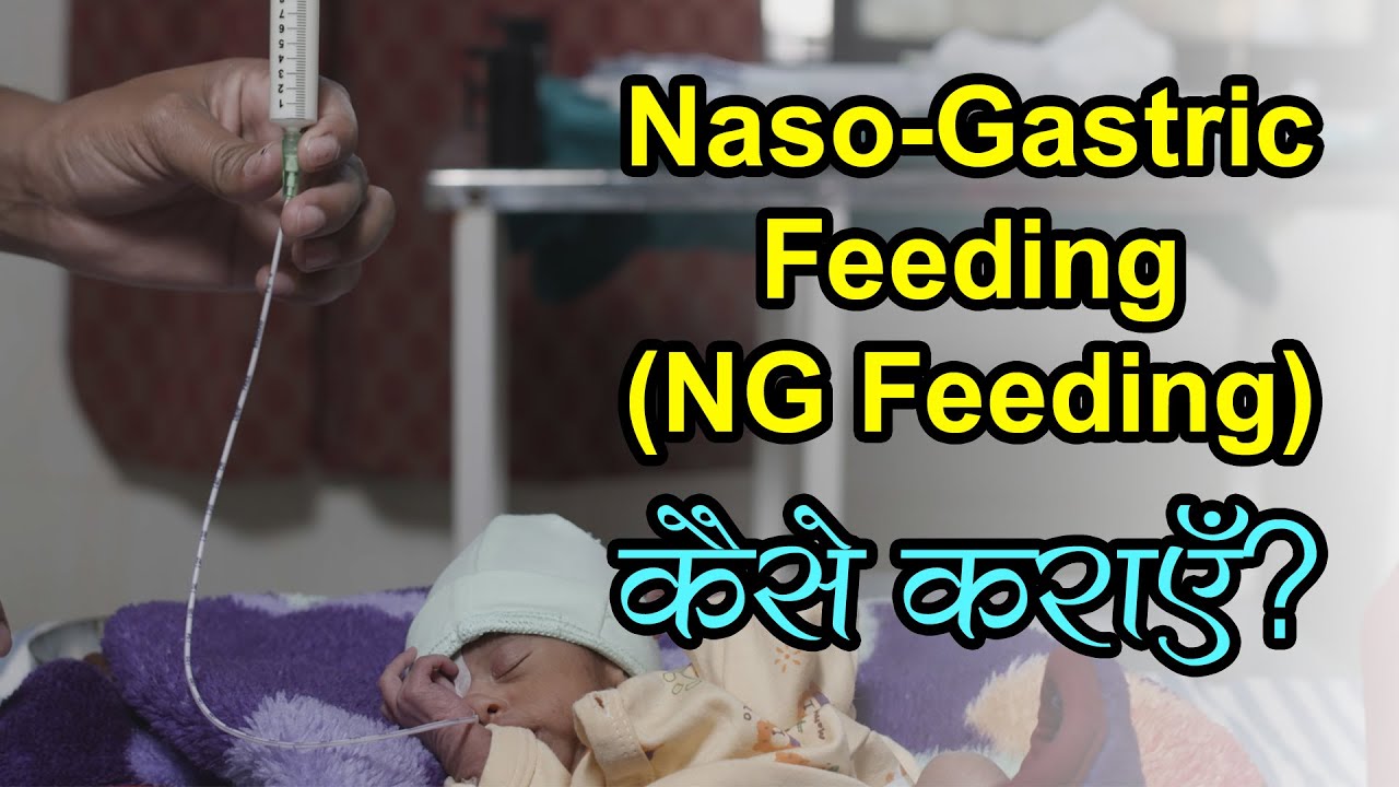 नवजात शिशु को Tube Feeding कैसे कराएँ | How to insert NG Tube | Naso-Gastric Feeding