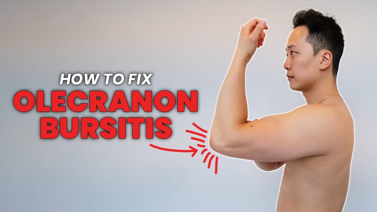 How to do exercises for Olecranon Bursitis - One cause of elbow pain in the triceps region