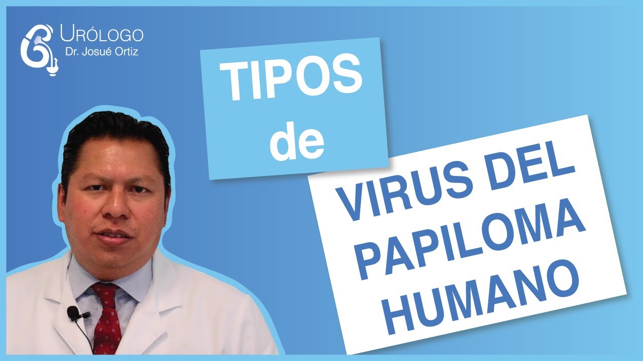 TIPOS de VIRUS DEL PAPILOMA HUMANO - UR&Oacute;LOGO Josu&eacute; Ortiz