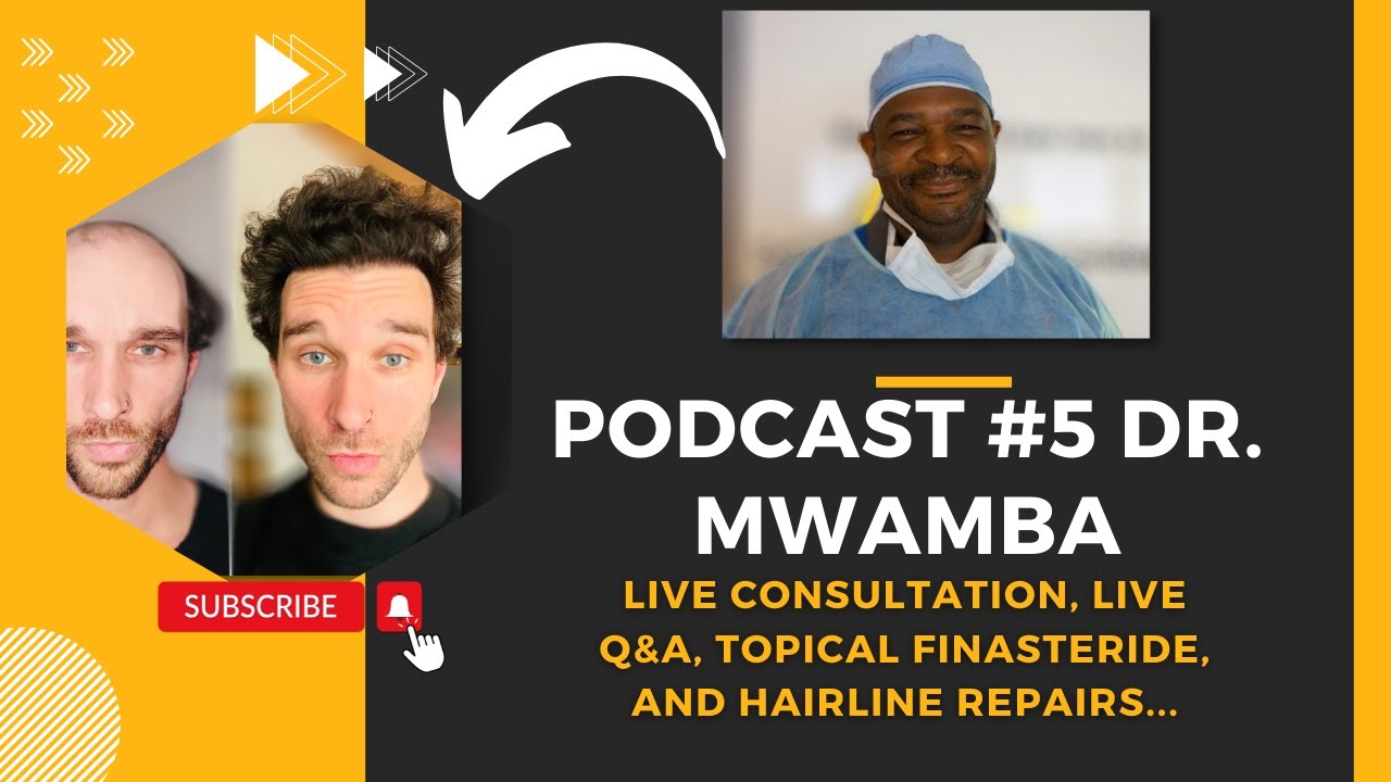 Hair Transplant Network Podcast #5 Dr. Mwamba- Live Q&A, Hairline Repairs, and Topical Finasteride