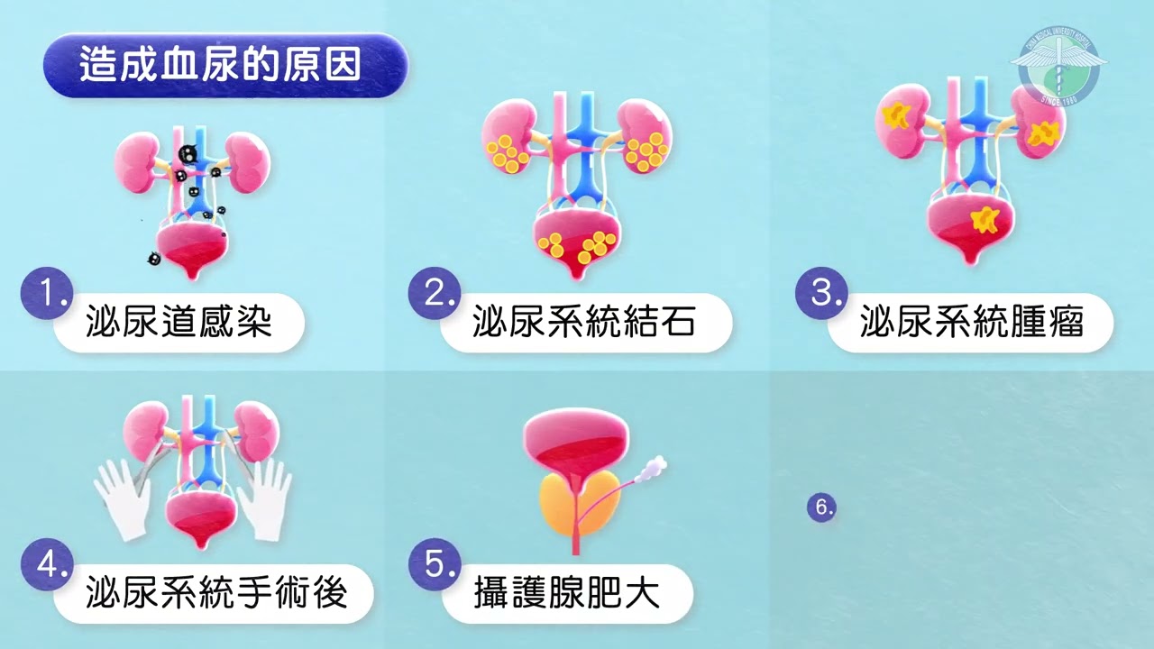20230523為什麼會血尿