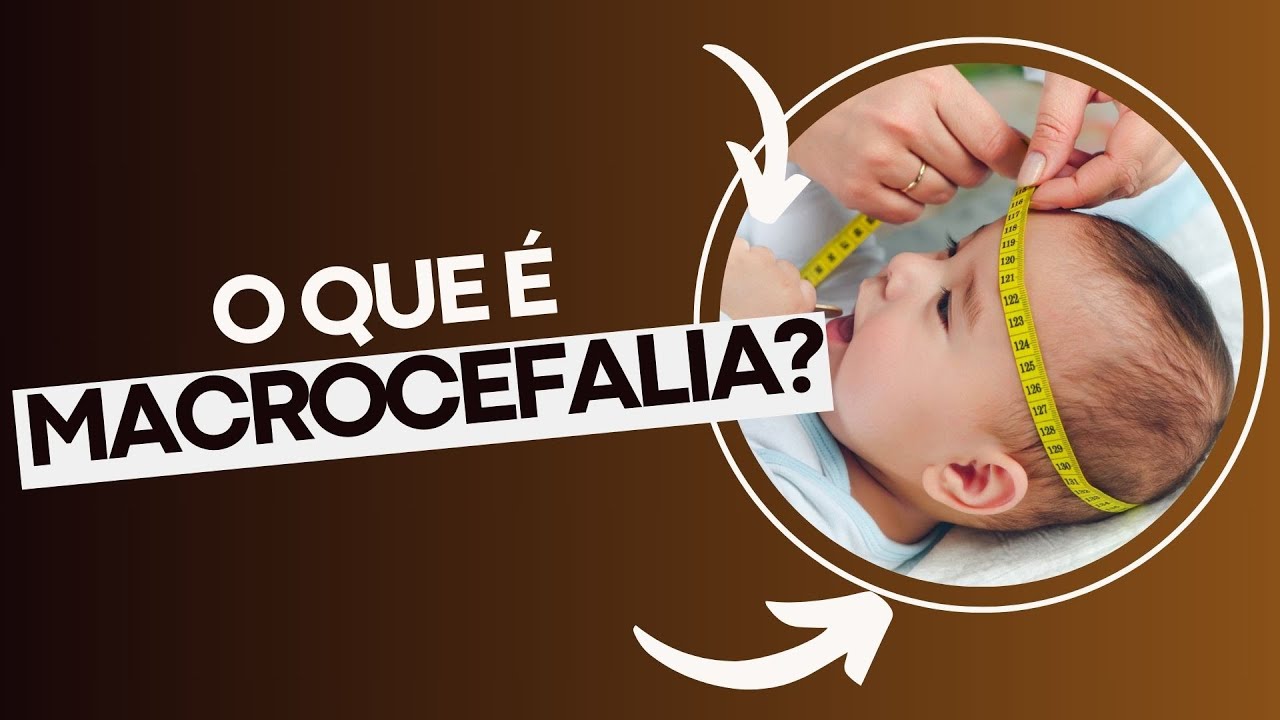 O que é Macrocefalia (Macrocrania)? Entenda as Causas e Sintomas