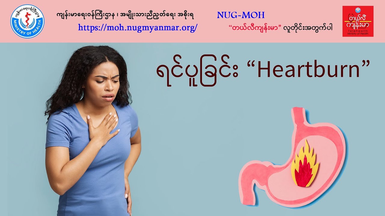ရင်ပူခြင်း (Heartburn)