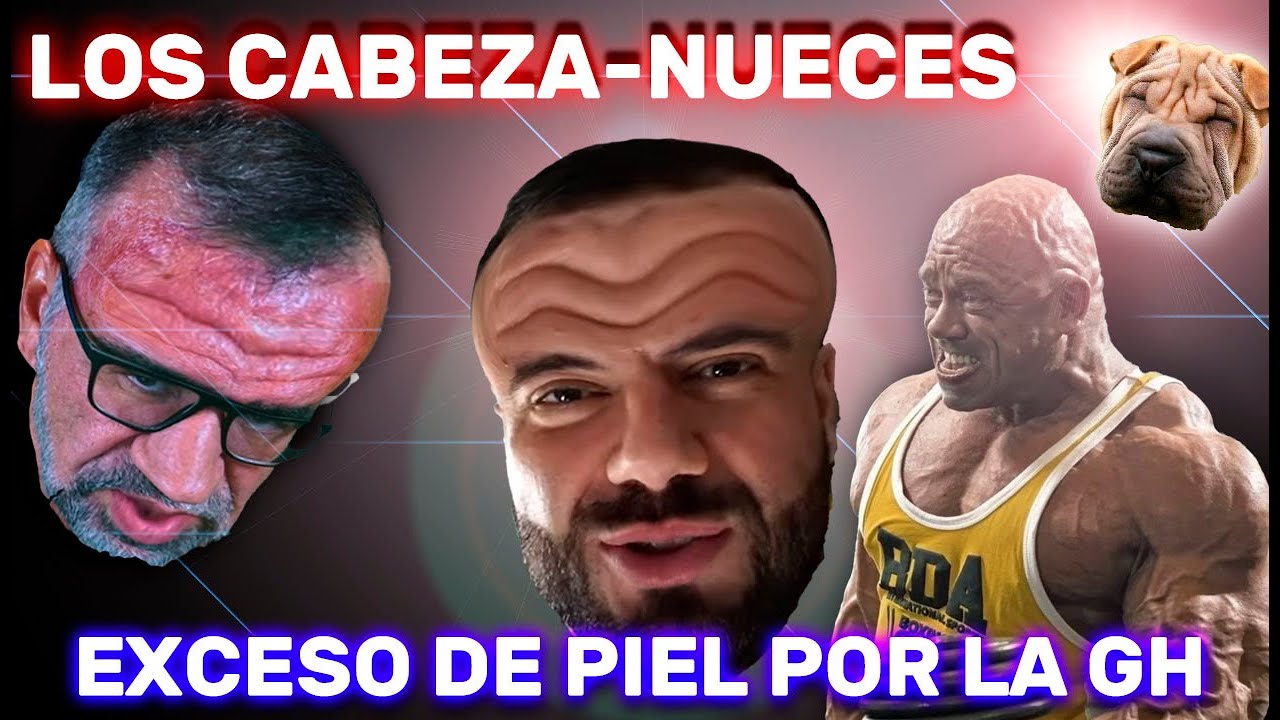 PELLEJUDOS, LOS MONSTRUOS DE LA GH