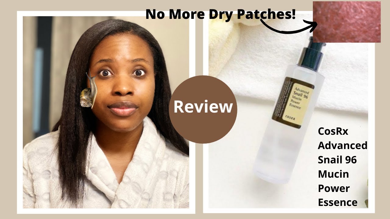 Watch this before you buy: COSRX SNAIL ESSENCE REVIEW ⎜On Oily vs Dry Skin