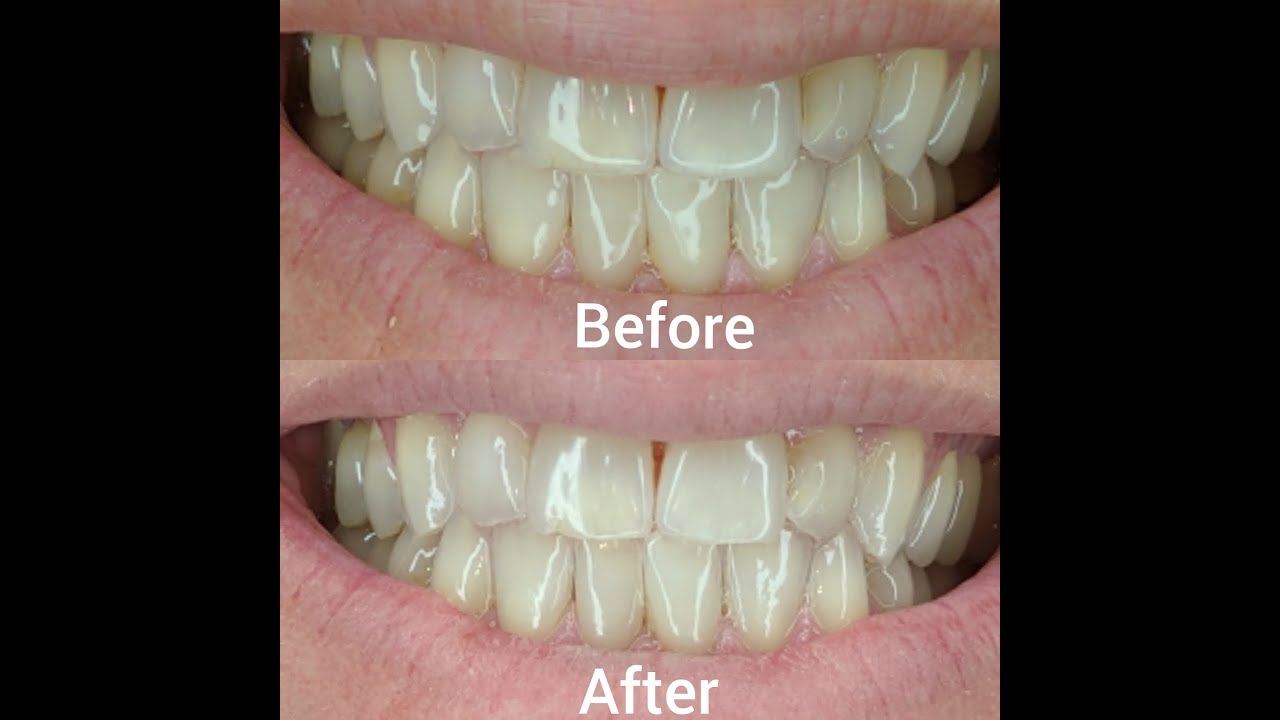 AP24 Whitening Toothpaste Review