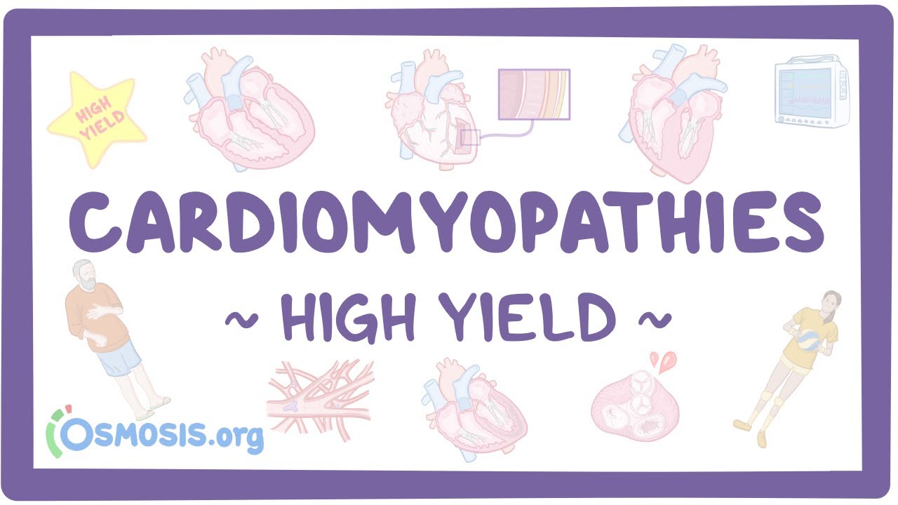 Cardiomyopathies: Pathology review