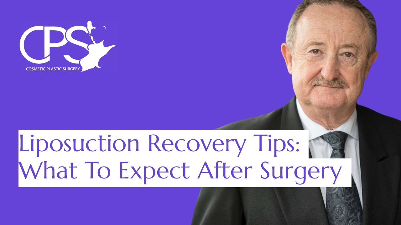 Liposuction Recovery Tips: What To Expect After Surgery