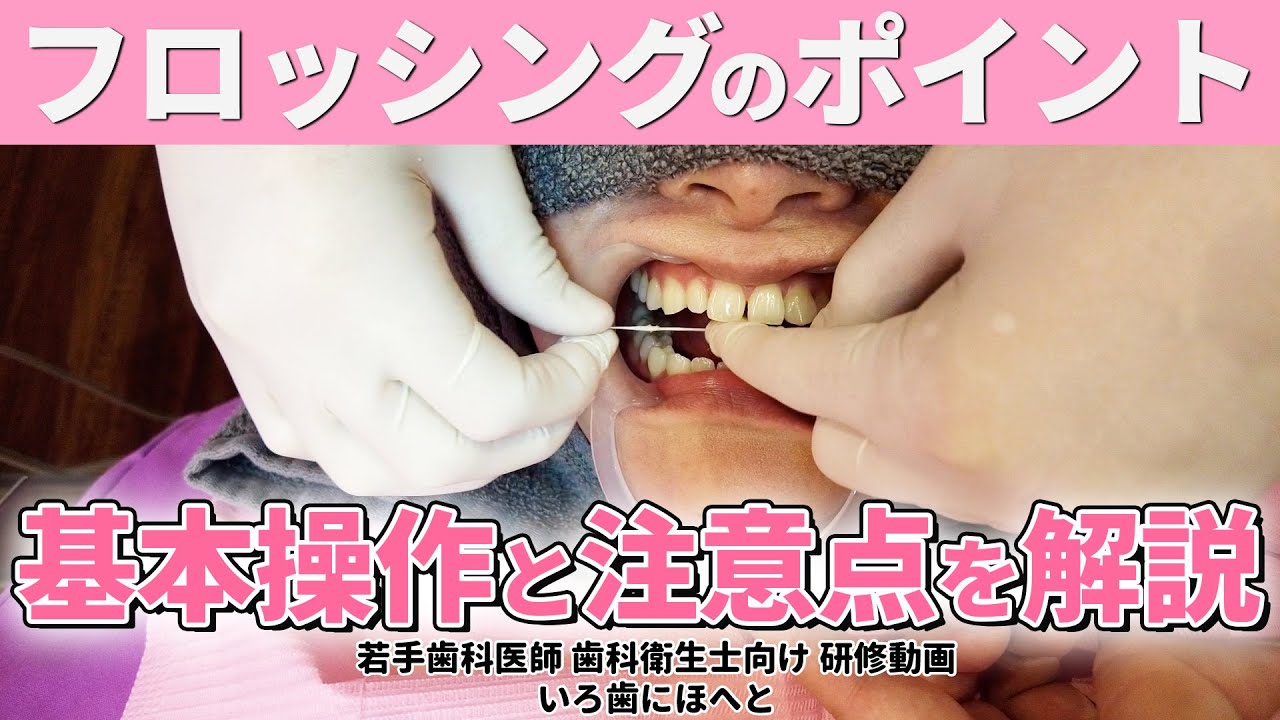 【歯科衛生士向け】フロッシングのポイント