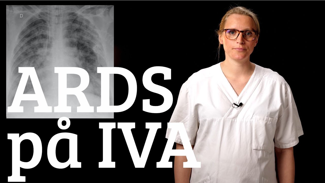 ARDS på IVA