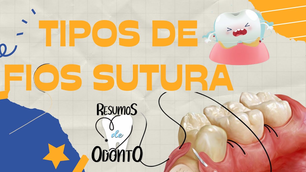 TIPOS DE FIOS DE SUTURA UTILIZADOS NA ODONTOLOGIA