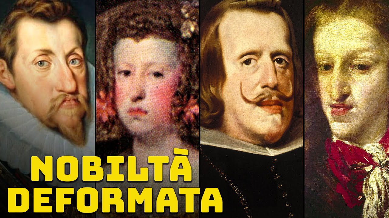 5 Re Che Soffrivano di Malattie Causate da Rapporti tra Parenti