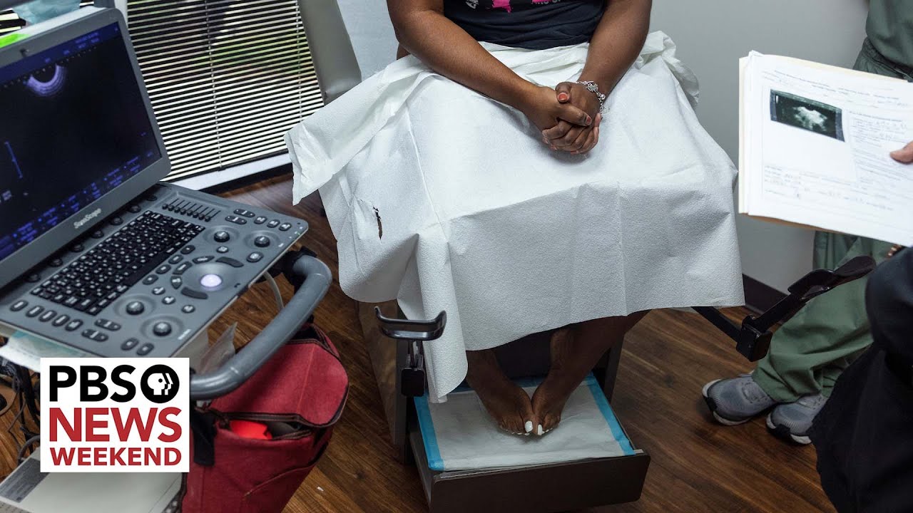 Texas woman describes ordeal with state abortion law after miscarriage