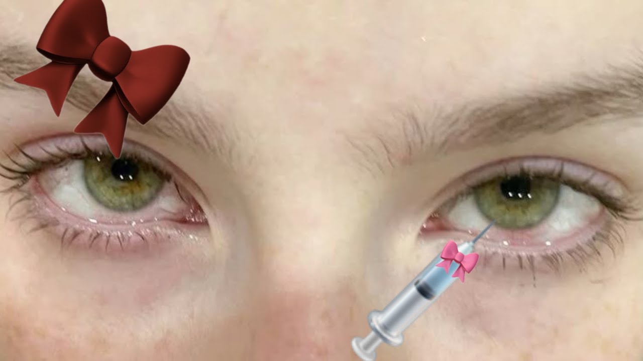 Greens eyes 💉💚🎀 اعين خضراء 