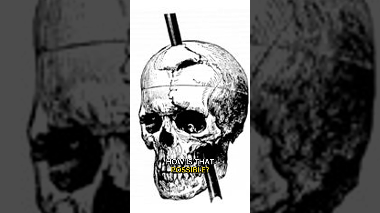 The Man Who Survived an Iron Rod Through the Brain