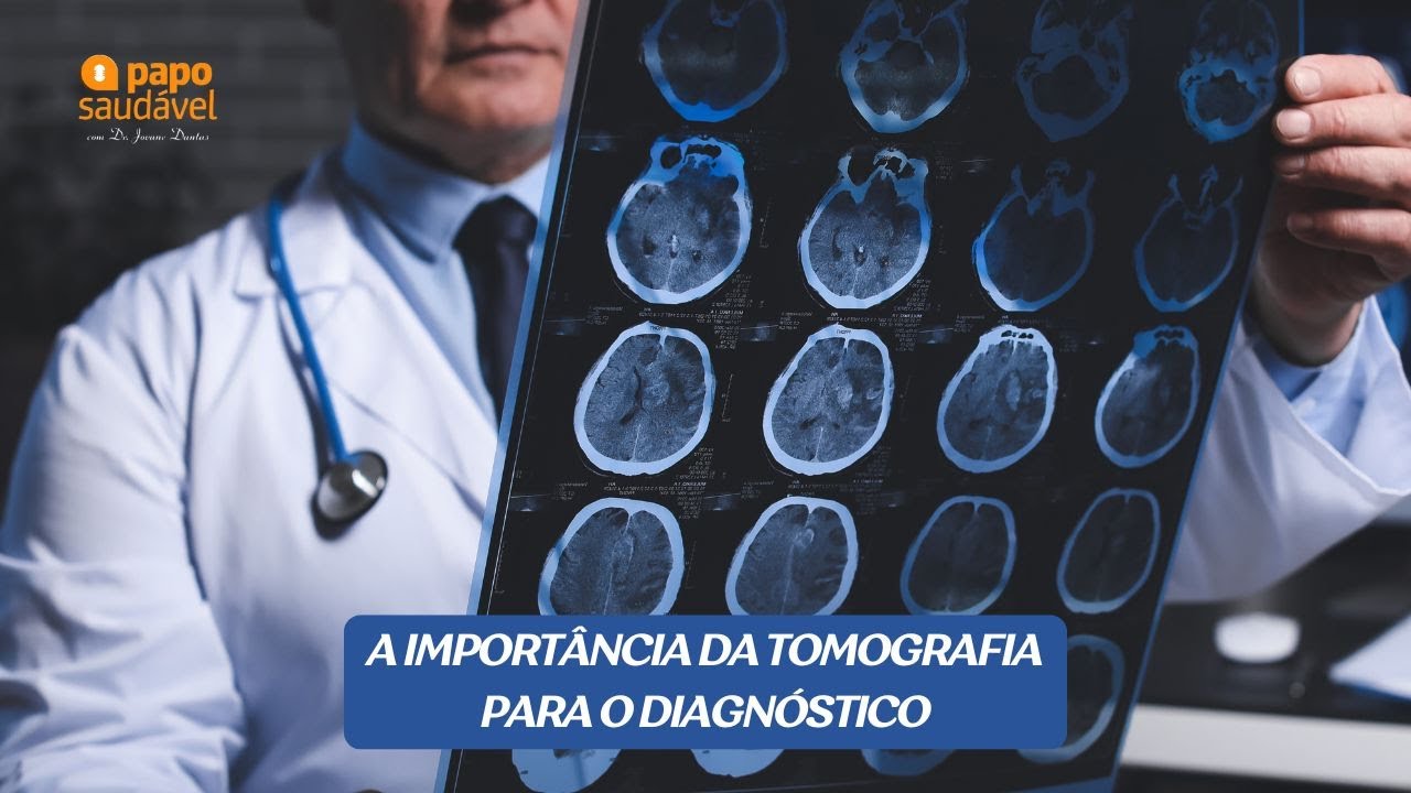 PODCAST PAPO SAUDÁVEL) A IMPORTÂNCIA DA TOMOGRAFIA PARA DIAGNÓSTICO) - 28/01/2026