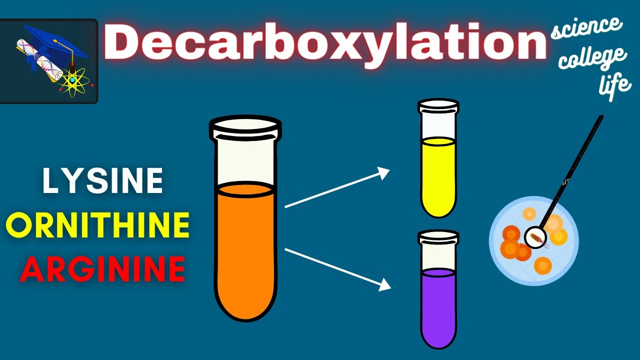 Amino Acid Decarboxylation Test | Microbiology Lab