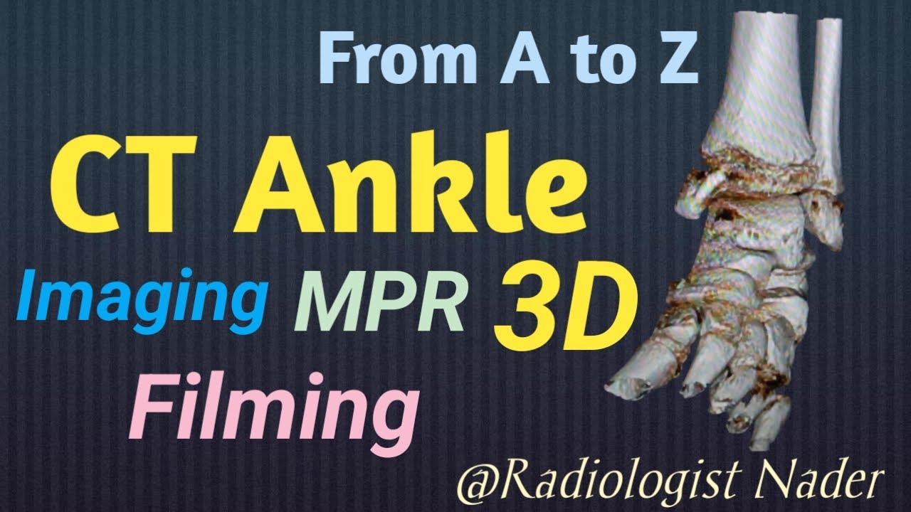 اشعة مقطعية علي مفصل الكاحل|تصوير|ريفورمات|3DCT Ankle joint|Imaging|MPR|3D