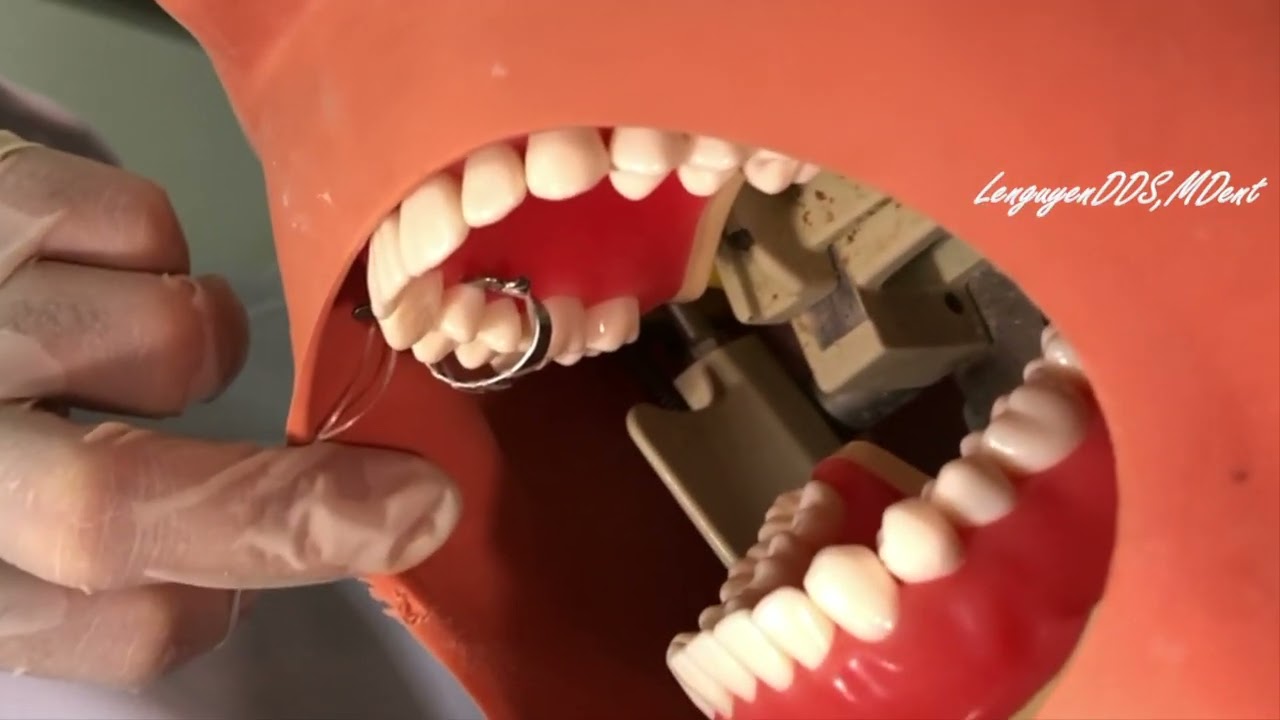 Perform dental rubber dam placement in the maxillary premolars