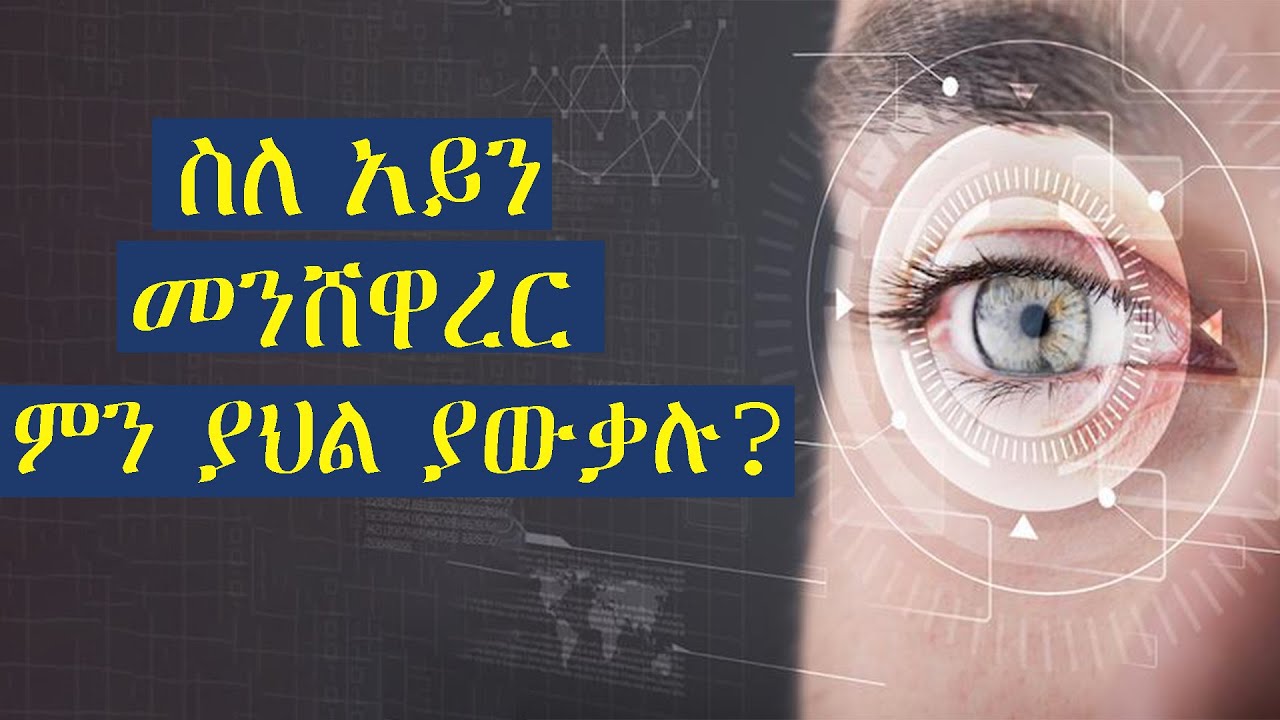 Ethiopian Medical Show : ስለ አይን መንሸዋረር ምን ያህል ያውቃሉ ?