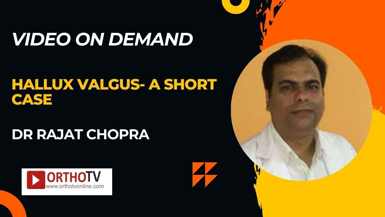 Hallux valgus- A short case - Dr Rajat Chopra