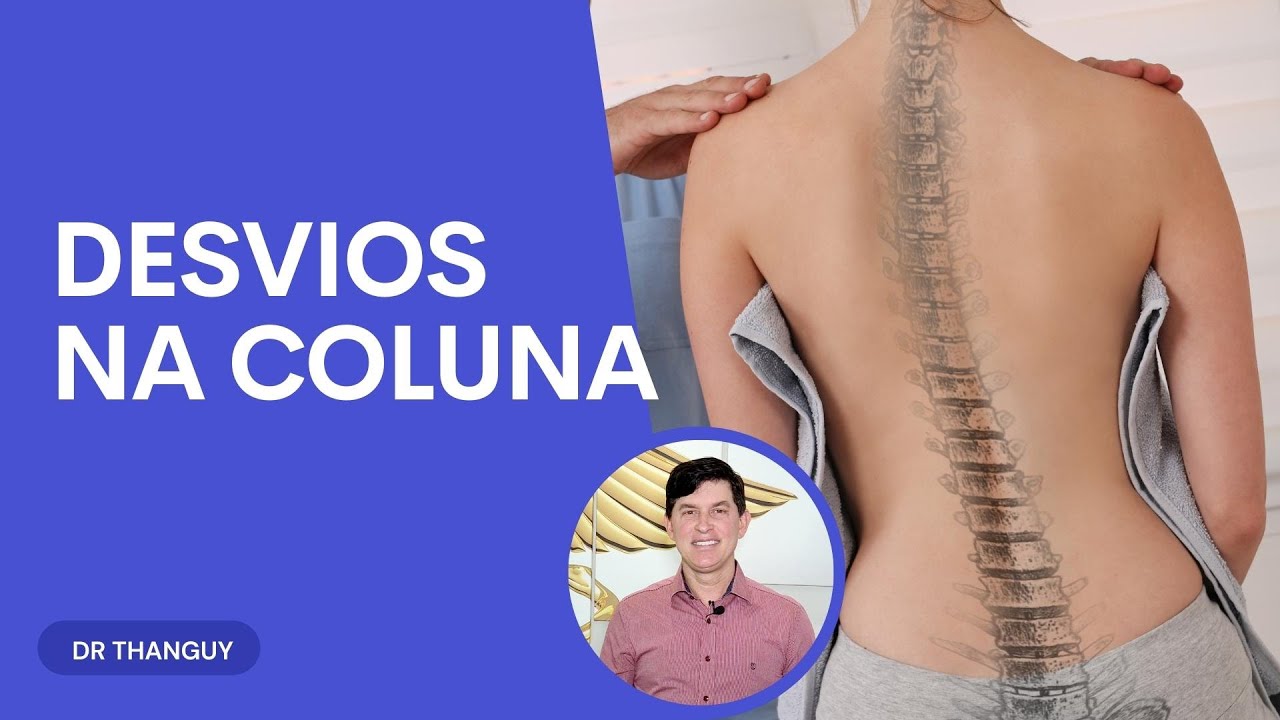 Desvios na coluna: sintomas e tratamento - Dr. Thanguy