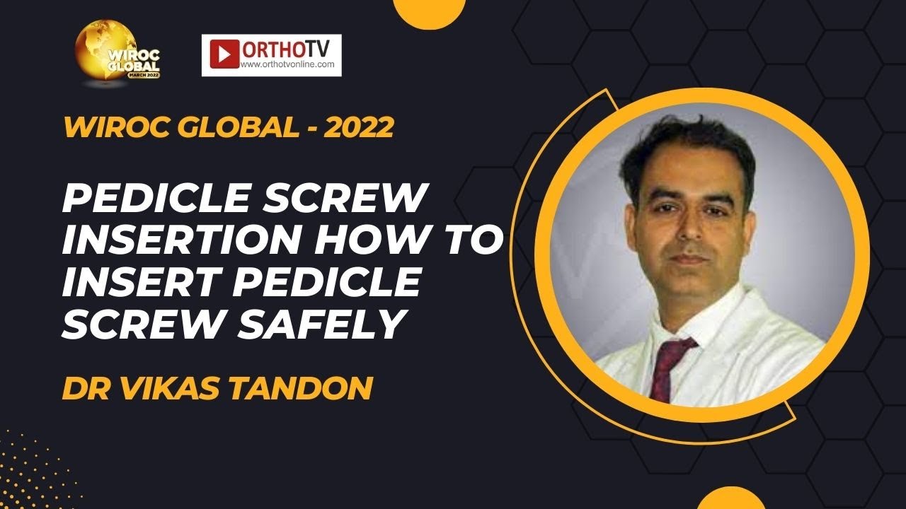 Wiroc Global 2022 : PEDICLE SCREW INSERTION How to insert pedicle screw safely - Dr Vikas Tandon