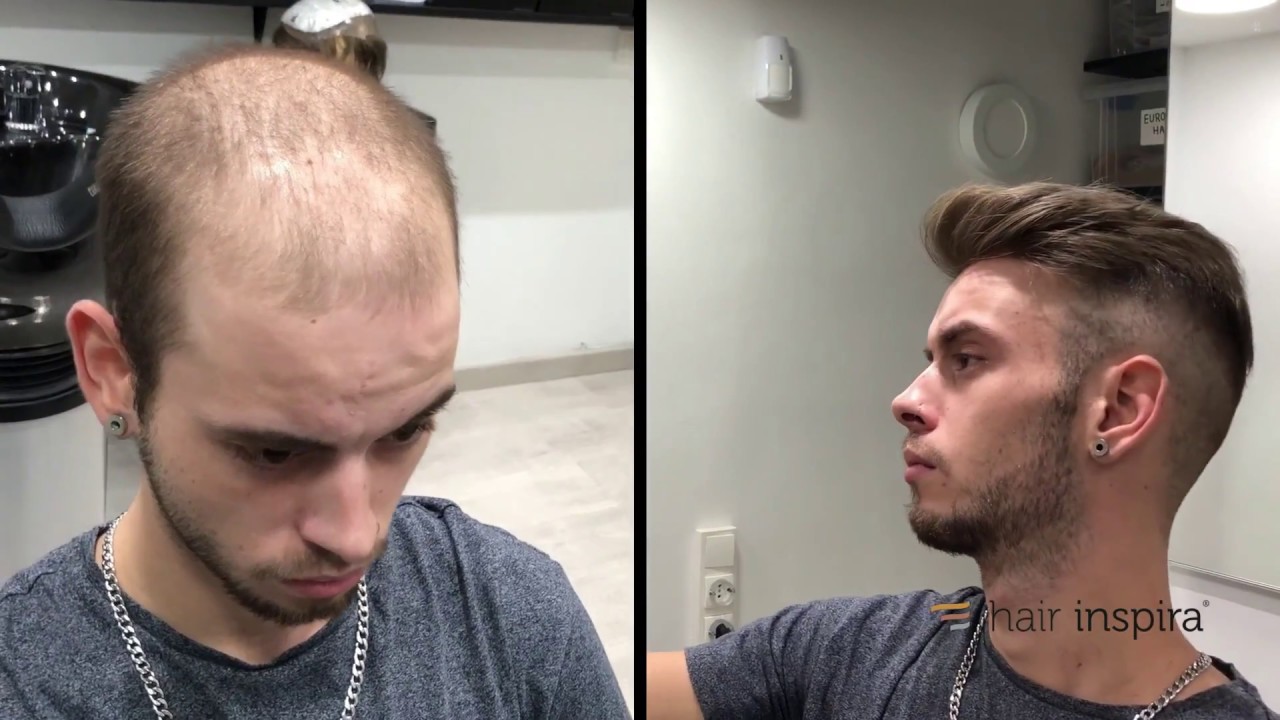 Hair Replacement fitting video (David) part 2 – Hair Inspira