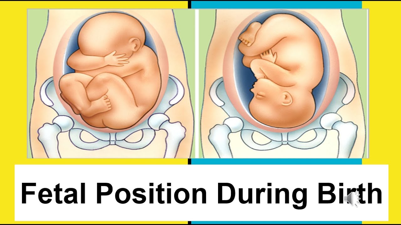 Fetal Presentation Considerations During Pregnancy & Birth - Empowering Midwifery Education