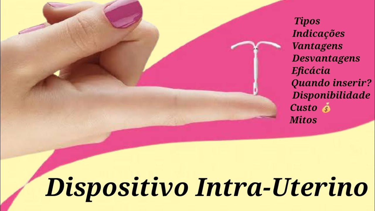 DIU - Dispositivo Intra-Uterino