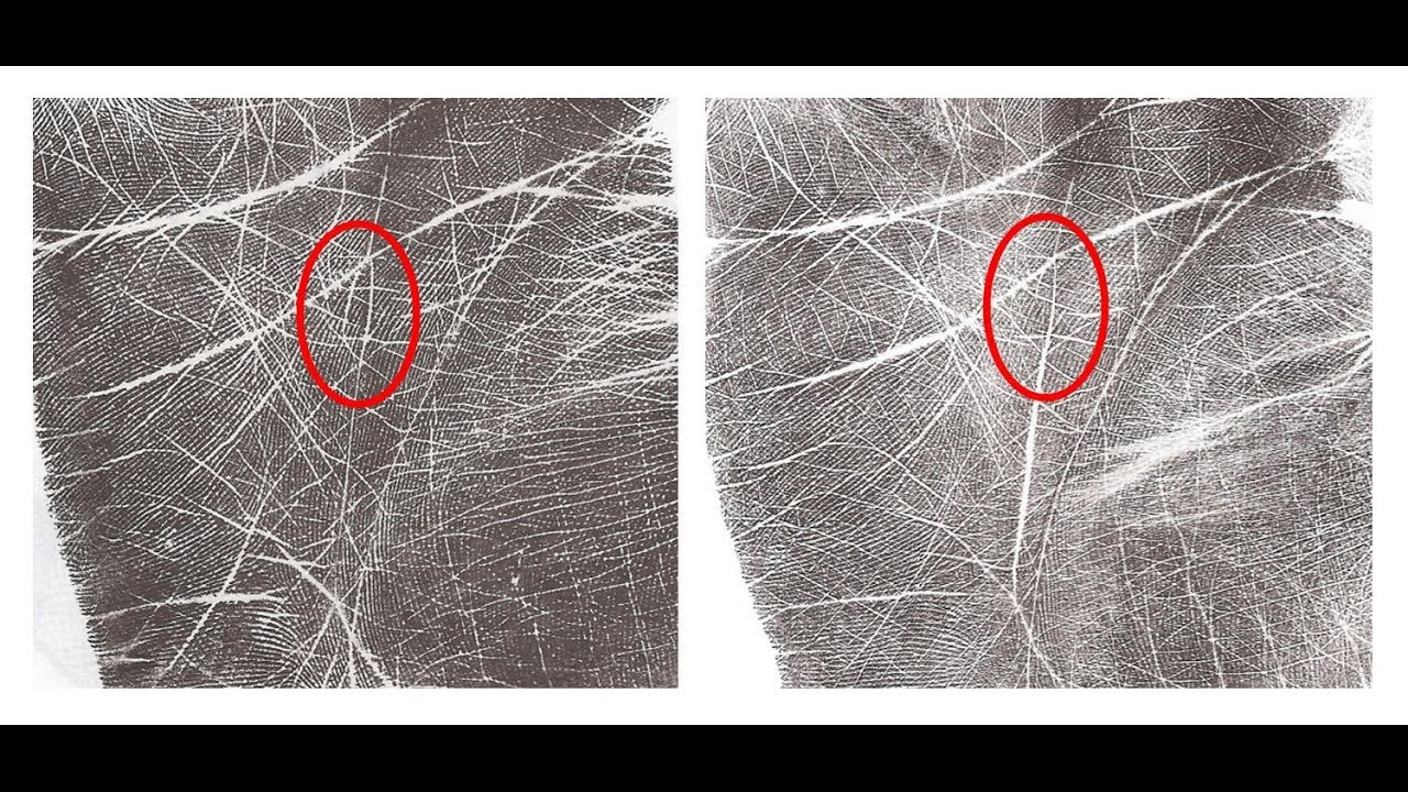 How to Remove a Bad Sign - Amazing Changes in Palmistry