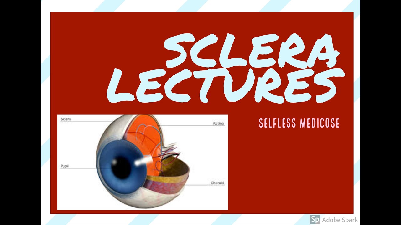 SCLERITIS full concept made easy part 2