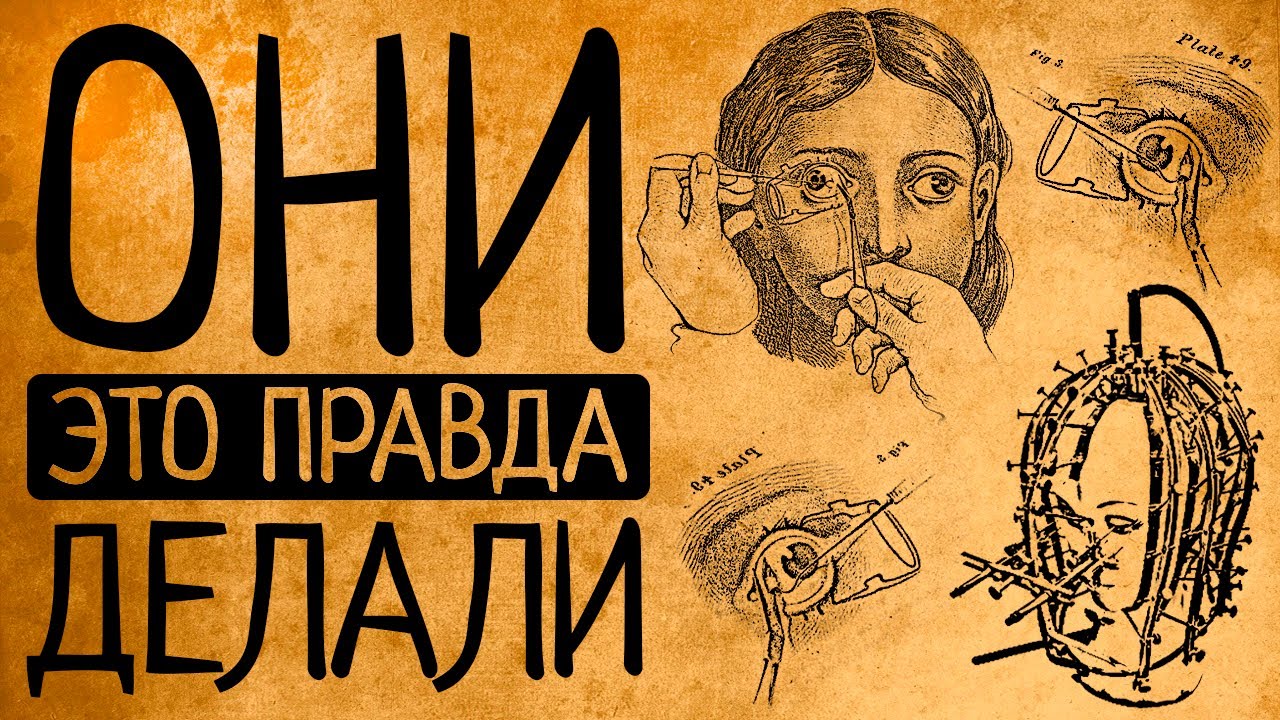 Самые дикие бьюти-процедуры прошлого, на которые отваживались женщины!