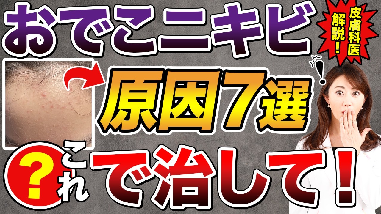 おでこにきび（額ニキビ）の原因と対処法は？ニキビ跡を残さない適切な治療法について皮膚科医が解説！