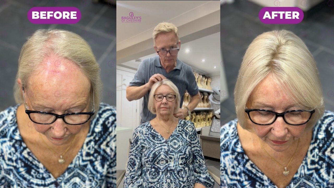 Human Hair Wigs for Hair loss | Most Realistic Human Hair Wig Transformation | Baguley's of Cheshire