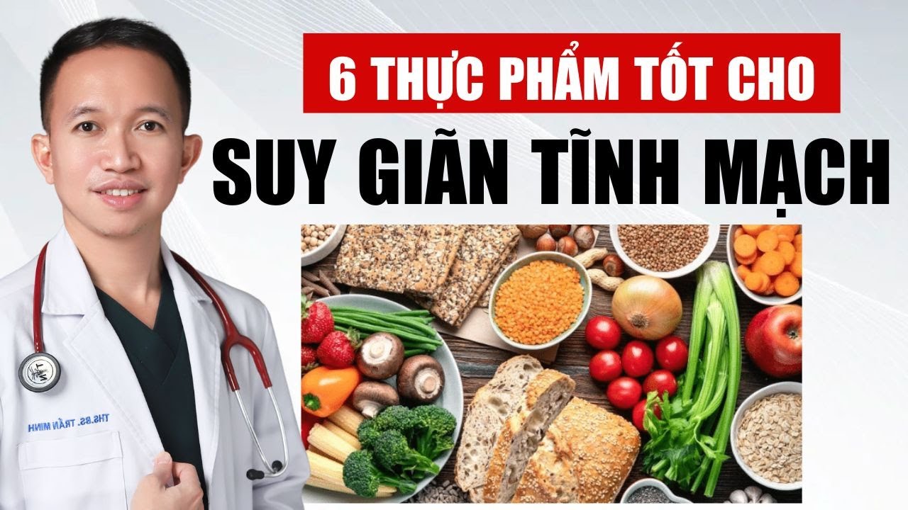 6 Thực Phẩm Tốt Cho Suy Gi&atilde;n Tĩnh Mạch | B&aacute;c Sĩ Trần Minh
