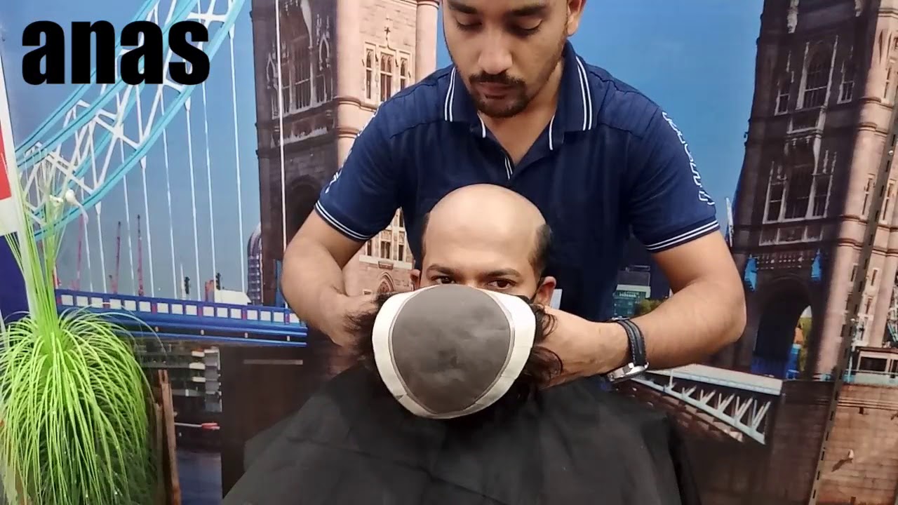 Looks good, feel good, non surgical hair treatment, consultant at whatsap or call📲 9650914665 anas