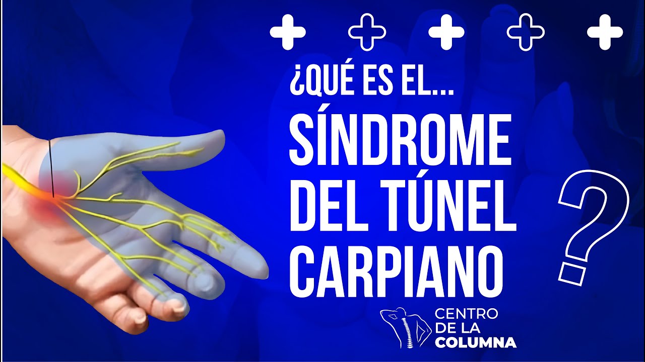 Túnel Carpiano: ¿Por qué se duermen tus manos?