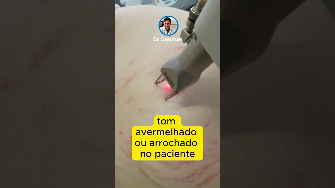 Quais os tipos de estrias?