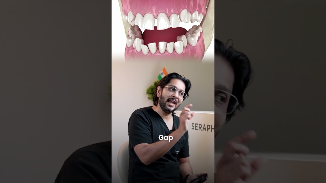 दाँतों में खाना फँसता है? 😬 वजह, उपाय और सही इलाज | Dentist Indore 