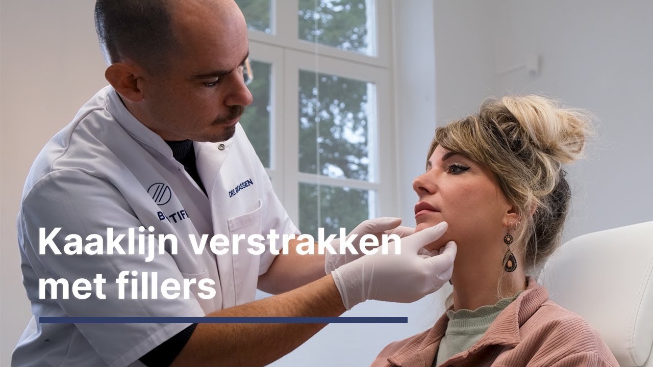 Kaaklijn verstrakken met fillers. Hoe doen we dat bij Beautifier?
