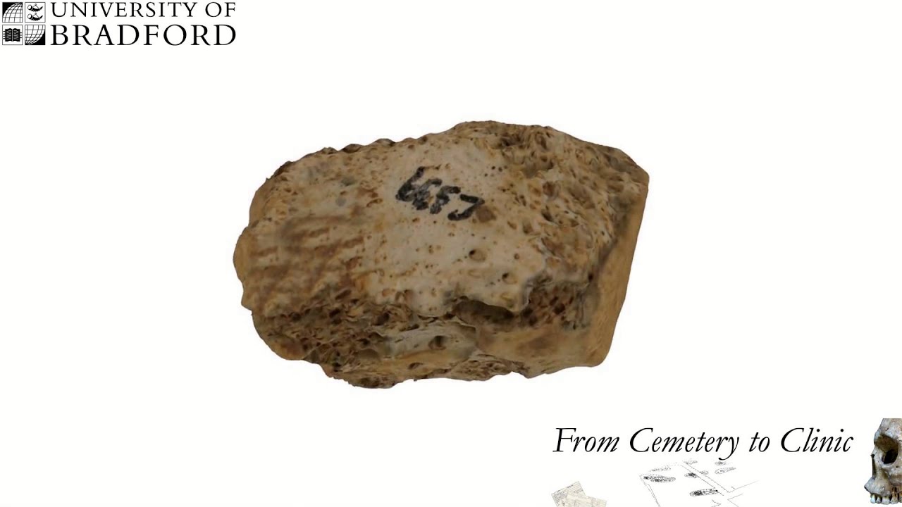 C339 Right Lateral Cuneiform