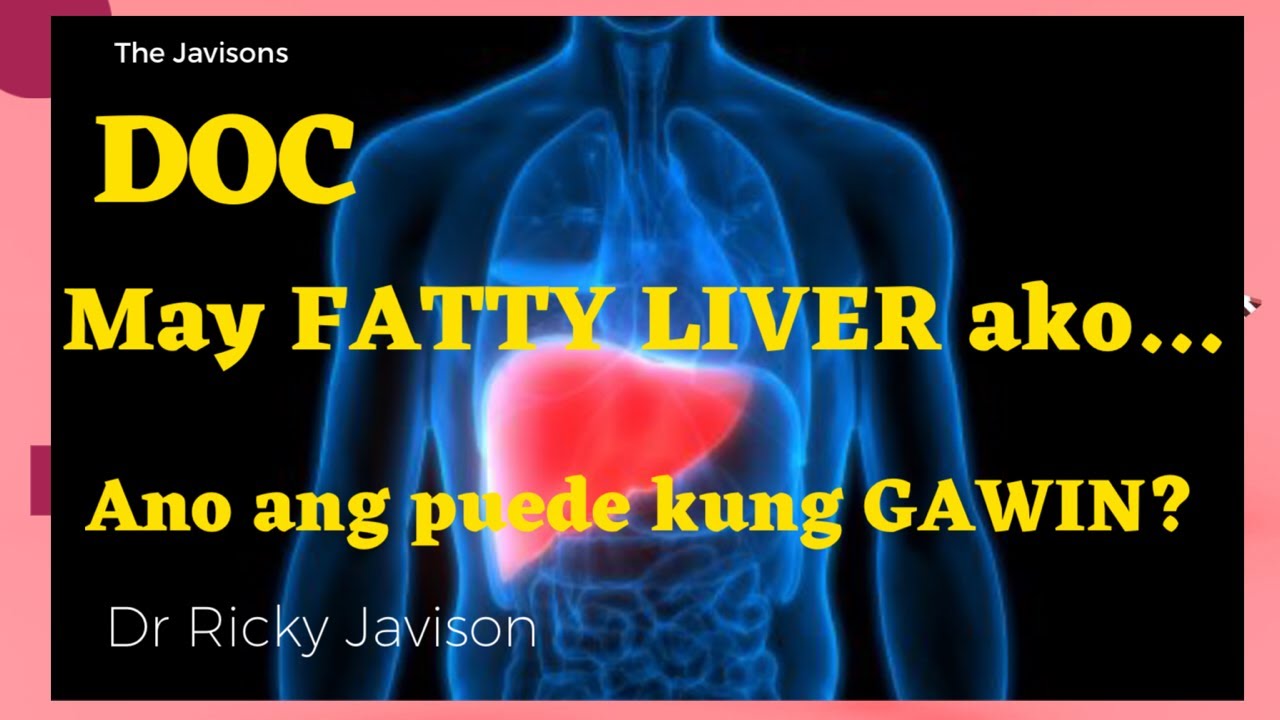 HOW TO Treat your FATTY LIVER? Gawin mo ito! Usapang Atay with Dr Ricky Javison
