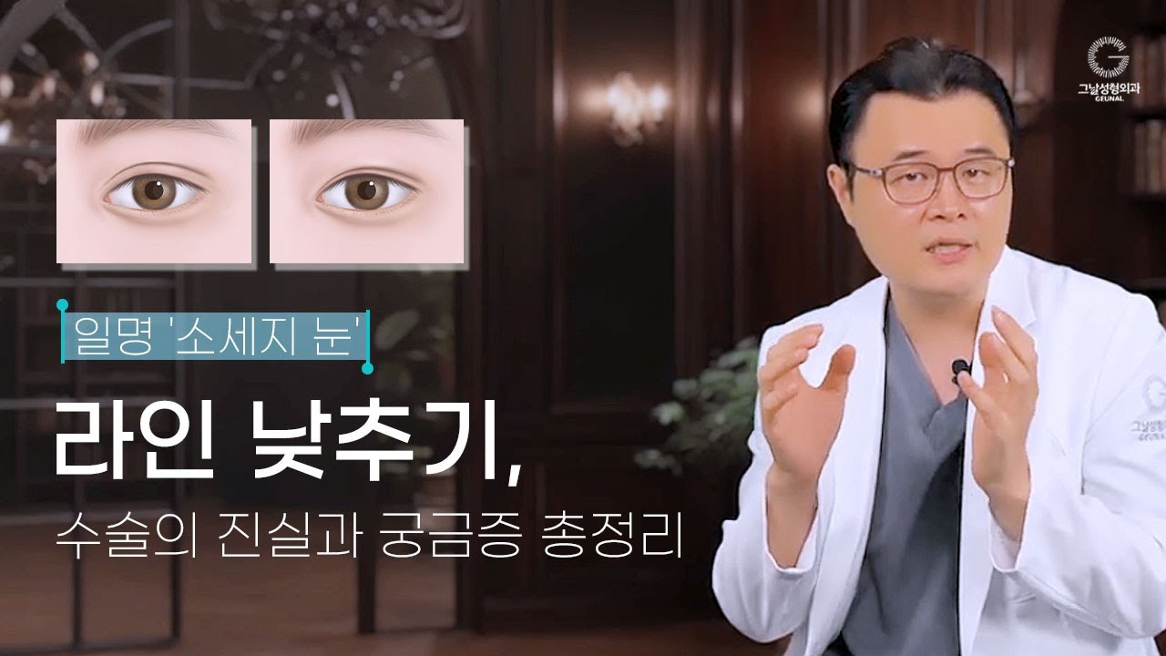 소세지눈=두줄따기? 흉터까지 해결?