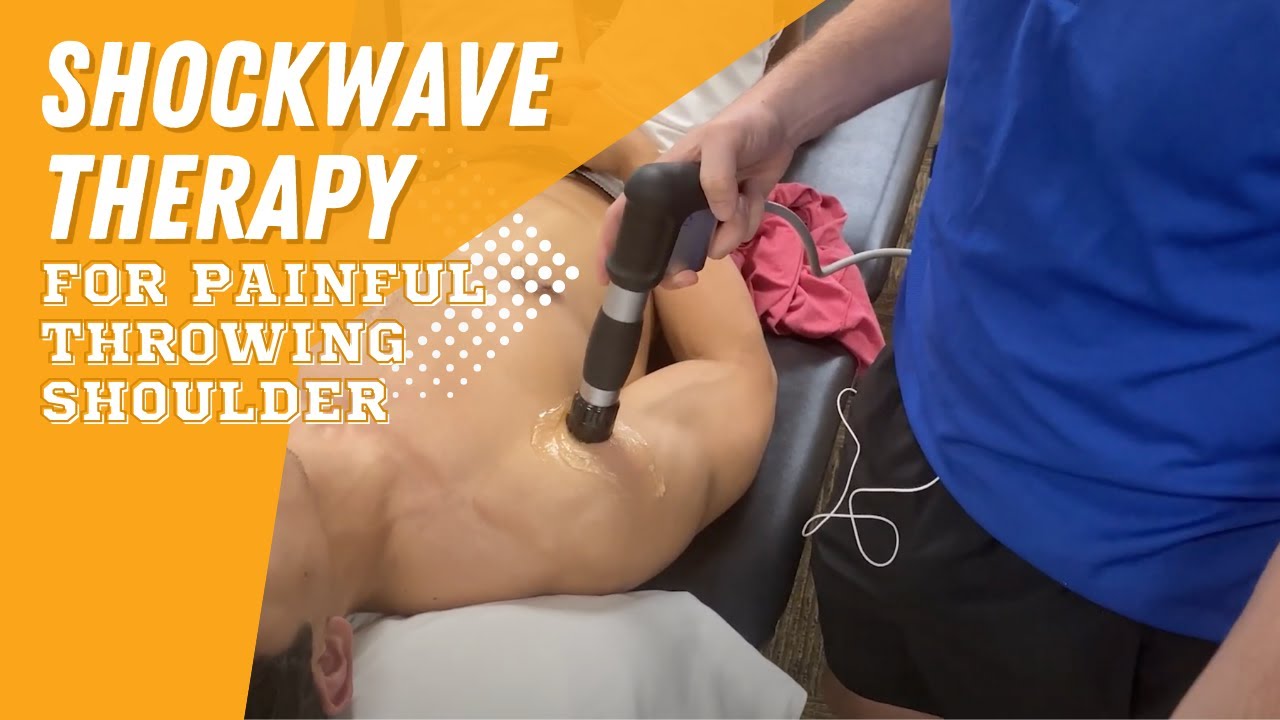 Shockwave Therapy for the Painful Throwing Shoulder