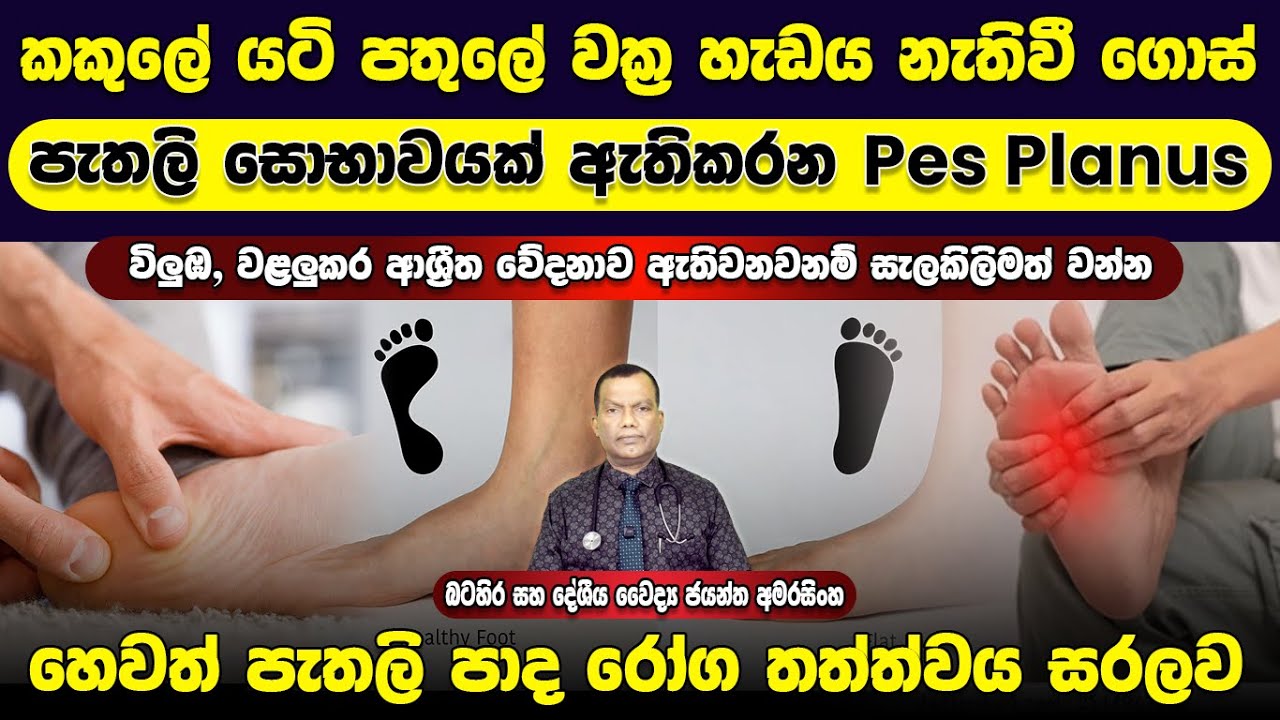 කකුලේ යටි පතුලේ වක්‍ර හැඩය නැතිවී පැතලි සොභාවයක් ඇති කරන pes planus හෙවත් පැතලි පාද රෝග තත්ත්වය