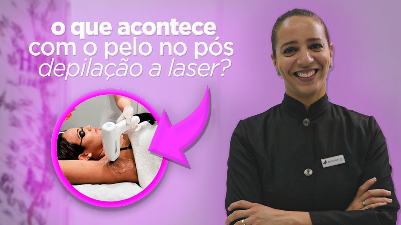 O que acontece com os pelos no pós depilação a laser?