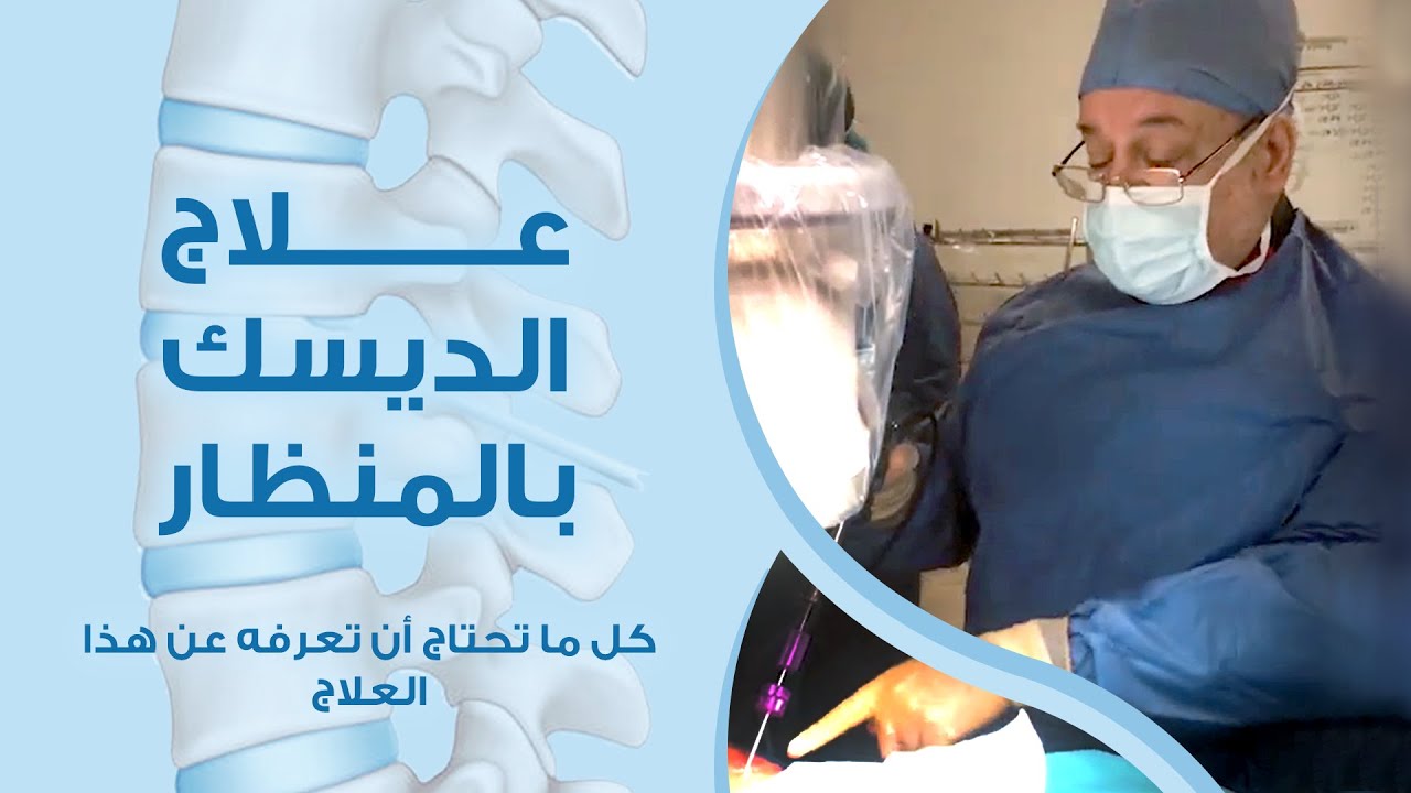 الدكتور عصام مارديني - علاج الديسك بالمنظار