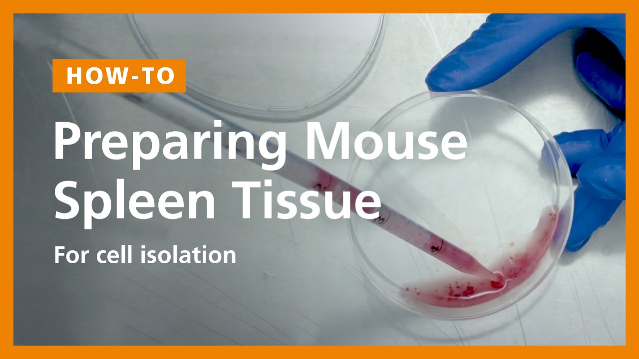 How to Prepare a Single-Cell Suspension from Mouse Spleen Tissue