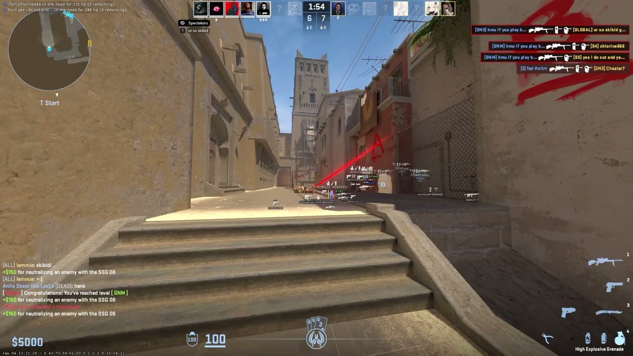 cs2 autism